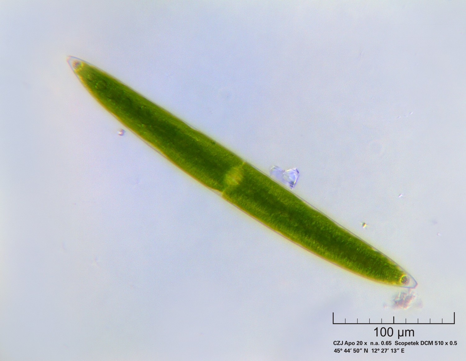 Closterium